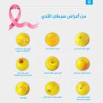 أحدث الإرشادات الطبية… لمعالجة ارتفاع ضغط الدم