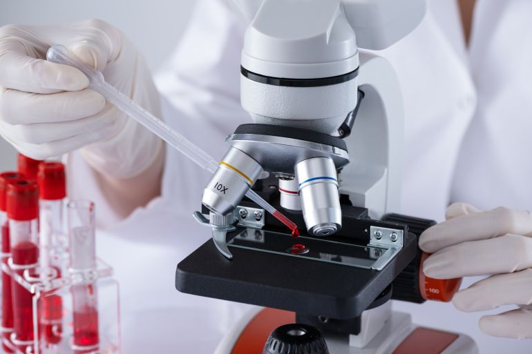 A scientist is using a microscope to examine a blood sample. Test tubes with blood in laboratory. Blood HIV test.